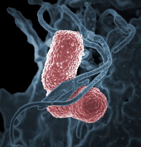 폐렴간균(Klebsiella pneumoniae) - 미국 국립알레르기전염병연구소(NIAID) 제공